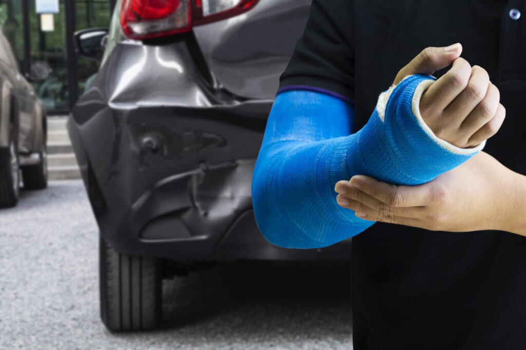 Catastrophic Injury after accident